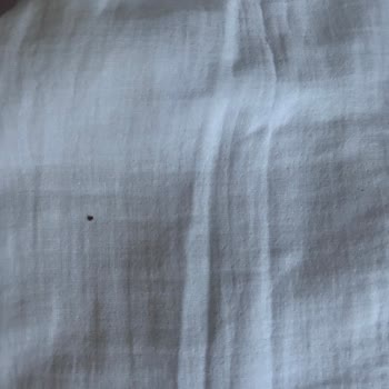 Hasarlı Ve Lekeli Ürün Teslimatı, Yetersiz Müşteri Desteği