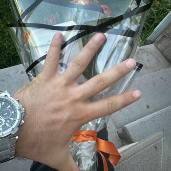 Görsel Onaylı Siparişim Farklı Ve Eksik Geldi