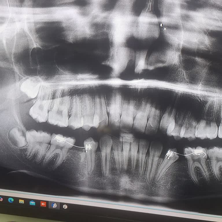Çocuğumun Diş Tedavisinde Yaşanan Mağduriyet Ve Sürekli Tekrar Eden Sorunlar