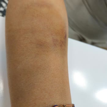 Yanlış Montaj Sonucu Termosifon Kazası: Hem Eşyalarım Hem Sağlığımız Zarar Gördü!