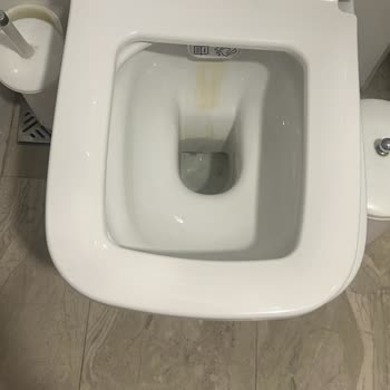 Asos Eden Beach Hotel'de Hijyen Ve Hizmet Skandalı: Tatilimiz Kabusa Döndü