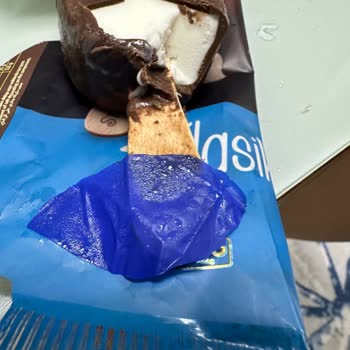 Dondurmadan Çıkan Yabancı Cisim Şoku!