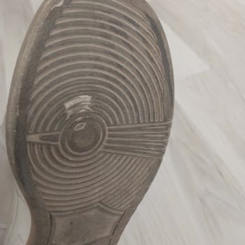 Bir Haftada Eriyen Ayakkabıya Red Cevabı Ve İlgisizlik