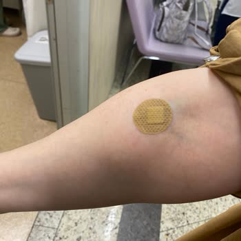 Erdem Hastanesi Check-up Sonrası Oluşan Morarma İçin Hastaneden Sorumluluk Bekliyoruz