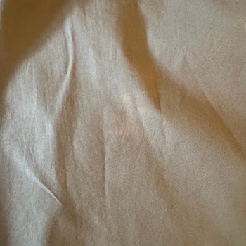 Yeni Alınan Etek Yıkama Sonrası Lekelendi, Mağduriyetim Giderilmedi