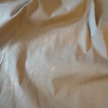 Yeni Alınan Etek Yıkama Sonrası Lekelendi, Mağduriyetim Giderilmedi