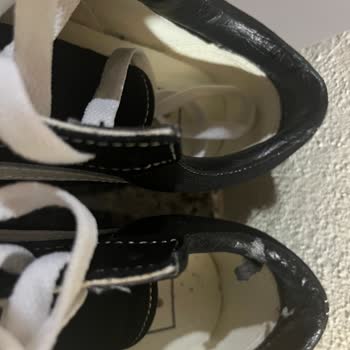 Vans Ayakkabıda Tekrarlayan Deri Soyulması Sorunu Hayal Kırıklığı Yarattı