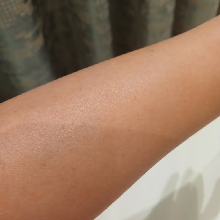 Nivea Güneş Ürünleri Cildimi Korumadı, Leke Yaptı!