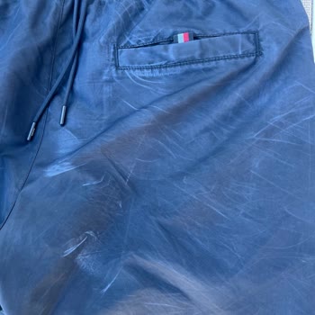 Tommy Hilfiger Deniz Şort Mayosunda Kalıcı Leke Sorunu Ve İade Reddi