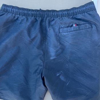 Tommy Hilfiger Deniz Şort Mayosunda Kalıcı Leke Sorunu Ve İade Reddi