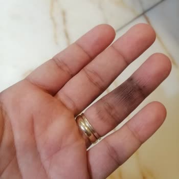 Arzum Saç Kurutma Makinesi Elimde Patladı, Para İadesi Yapılmadı