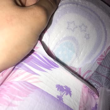 Orkid Platinum 5 Gece Modelinde Yüzey Değişikliği Ve Cilt Sorunları