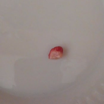 Aldığımız Sucuğun İçinden Kemik Çıkması Bizi Şaşırttı