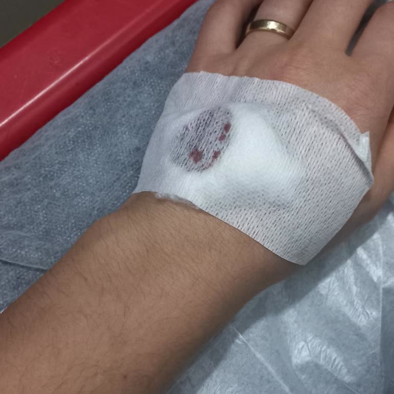 Hastanede Stajyer Hemşirenin Hatalı Damar Yolu Açması Sonucu Yaşanan Mağduriyet