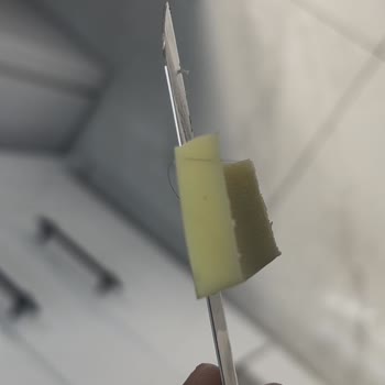 Muratbey Aldığım Kaşar Peynirinden Saç Çıkması Ve Yetersiz Çözüm