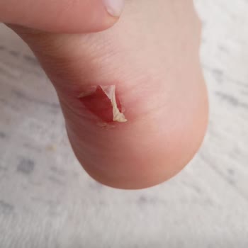 Puma Ayakkabı Bir Saat Giymeden Ayağımı Rahatsız Etti