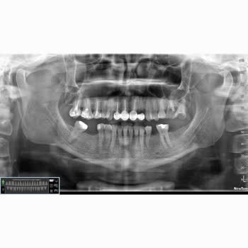 Önceden Yapılmış Tedaviye Tekrar Ücret Alındı, Param İade Edilmiyor
