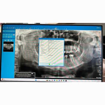 Önceden Yapılmış Tedaviye Tekrar Ücret Alındı, Param İade Edilmiyor