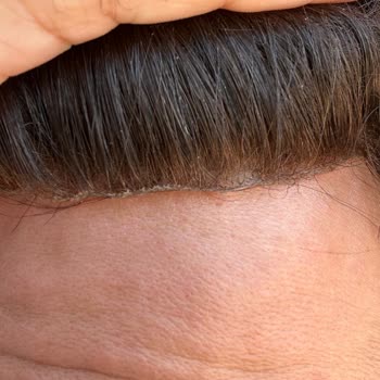 Demo Hair Gerçek Saç Diye Aldık, Paramız İade Edilmiyor!