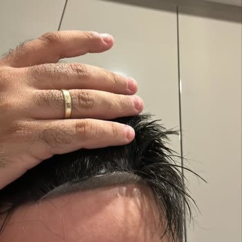 Demo Hair Gerçek Saç Diye Aldık, Paramız İade Edilmiyor!