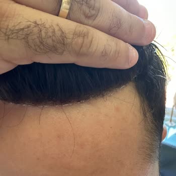 Demo Hair Gerçek Saç Diye Aldık, Paramız İade Edilmiyor!