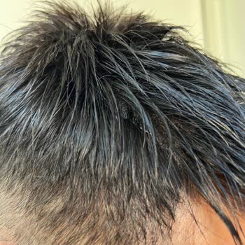 Demo Hair Gerçek Saç Diye Aldık, Paramız İade Edilmiyor!