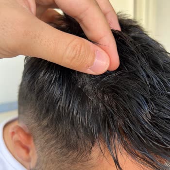 Demo Hair Gerçek Saç Diye Aldık, Paramız İade Edilmiyor!