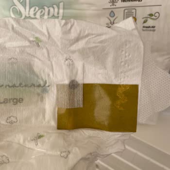 Sleepy Bebek Bezi Hijyen Sorunu Ve Hayal Kırıklığı