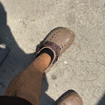 Yıllardır Düzelmeyen Alt Geçit Yüzünden Düşüp Zarar Gördüm