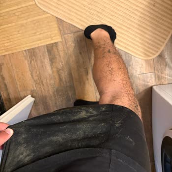 Yıllardır Düzelmeyen Alt Geçit Yüzünden Düşüp Zarar Gördüm