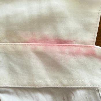 Domestos Kullanımı Sonrası Gömleğimde Kalıcı Leke Oluştu