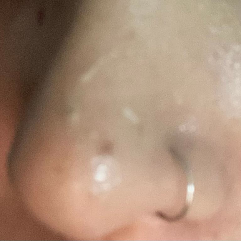 Dr Met Estetik Ve Zayıflama Merkezi Cildim Tahriş Oldu