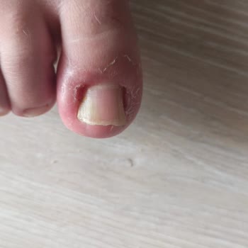 Inday Klinik Başarısız Operasyon Ve Yetersiz Klinik Hizmeti Sonrası Mağduriyet