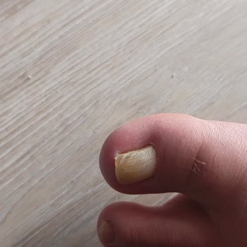 Inday Klinik Başarısız Operasyon Ve Yetersiz Klinik Hizmeti Sonrası Mağduriyet