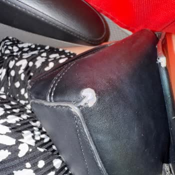 Calvin Klein Çantada Tekrarlayan Deri Soyulma Sorunu Ve Yetersiz Destek