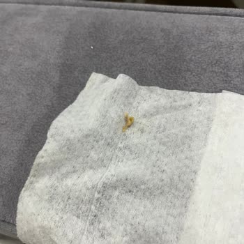 Dondurmadan Çıkan Yabancı Cisimler Ve İlgisiz Müşteri Hizmeti