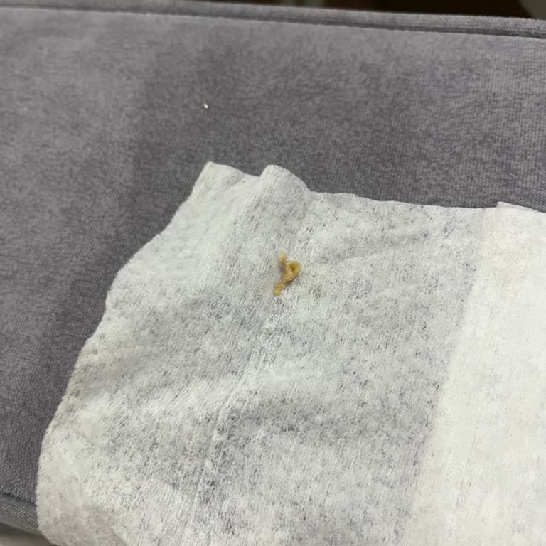 Dondurmadan Çıkan Yabancı Cisimler Ve İlgisiz Müşteri Hizmeti