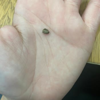 Müsli İçinde Taş Çıktı Dişimi Kırıyordum