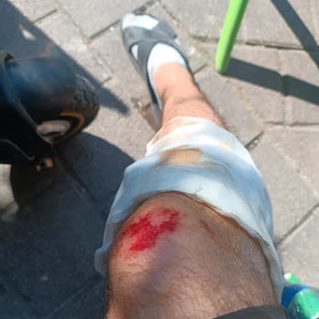 Electroll Torque 1600W Scooter'da Güvenlik Ve Dayanıklılık Sorunu