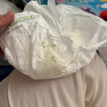 Islaklık Göstergesi Çalışmayan Bebek Bezi Mağduriyeti