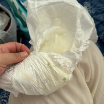 Islaklık Göstergesi Çalışmayan Bebek Bezi Mağduriyeti