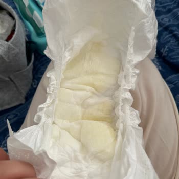 Islaklık Göstergesi Çalışmayan Bebek Bezi Mağduriyeti