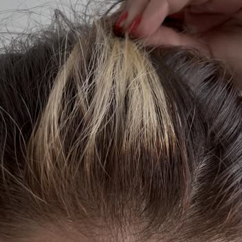 Sözde Kampanya Sonrası Yüksek Ücret Ve Kötü Saç Deneyimi