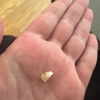 Mom's Natural Foods Çilekli Chia'dan Kocaman Ojeli Kadın Tırnağı Çıktı