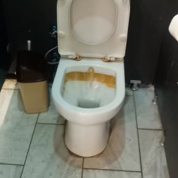 Kuşadası Vav Otelde Hijyen Eksikliği Nedeniyle Ailecek Sağlık Sorunları Yaşadık