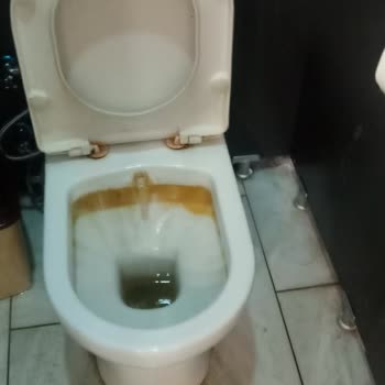 Kuşadası Vav Otelde Hijyen Eksikliği Nedeniyle Ailecek Sağlık Sorunları Yaşadık