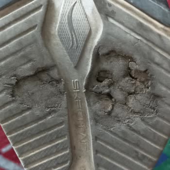 Skechers Ayakkabının Altı Kırıldı, Firma Üretim Hatasını Kabul Etmiyor
