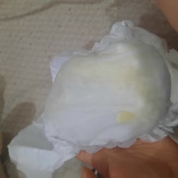 Sleepy Bebek Bezlerinde Pamukçuk Ve Cırt Cırt Kopması Sorunu Yaşadım