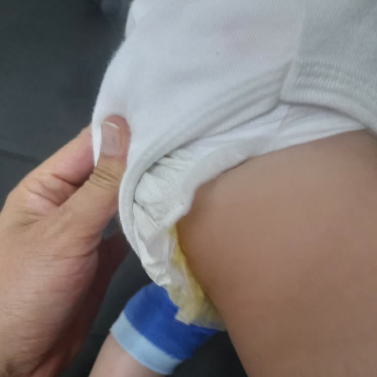 Bebek Bezinde Sızdırma Ve Yapışkan Sorunu Yaşadım