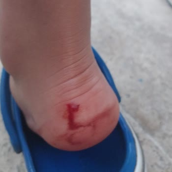Çocuk Parklarının Yetersizliği Ve Güvenlik Sorunları Endişe Yaratıyor